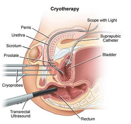 Masturbation After C Section 61